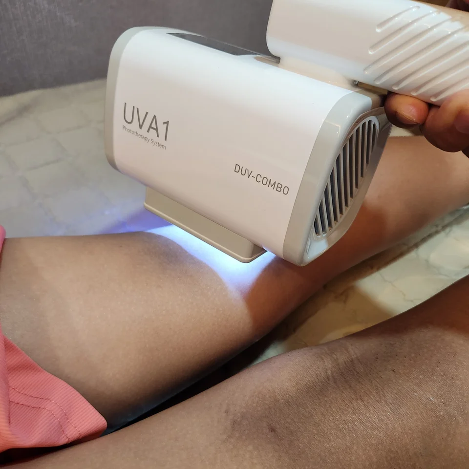 UVA1 조사 모습